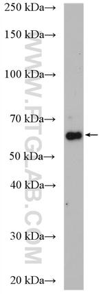 CARM1 Antibody in Western Blot (WB)