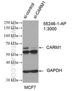 CARM1 Antibody in Western Blot (WB)