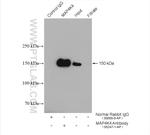 MAP4K4 Antibody in Immunoprecipitation (IP)