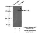 MAP4K4 Antibody in Immunoprecipitation (IP)