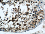 MORF4L1 Antibody in Immunohistochemistry (Paraffin) (IHC (P))