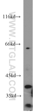 MORF4L1 Antibody in Western Blot (WB)