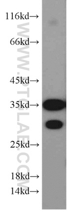 VDAC1/Porin Antibody in Western Blot (WB)