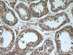 VDAC3 Antibody in Immunohistochemistry (Paraffin) (IHC (P))