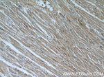 VDAC2 Antibody in Immunohistochemistry (Paraffin) (IHC (P))