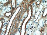 VDAC2 Antibody in Immunohistochemistry (Paraffin) (IHC (P))