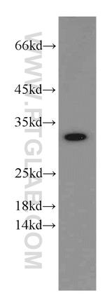 VDAC2 Antibody in Western Blot (WB)