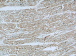 PARVA Antibody in Immunohistochemistry (Paraffin) (IHC (P))