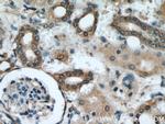 PARVA Antibody in Immunohistochemistry (Paraffin) (IHC (P))