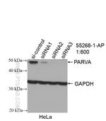 PARVA Antibody in Western Blot (WB)