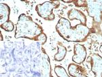 IMP-3 Antibody in Immunohistochemistry (Paraffin) (IHC (P))