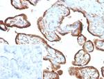 IMP-3 Antibody in Immunohistochemistry (Paraffin) (IHC (P))