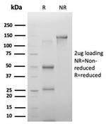 PHF10 (Transcription Factor) Antibody in SDS-PAGE (SDS-PAGE)