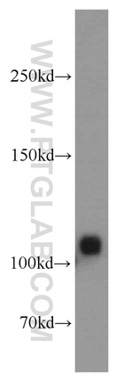 CASK Antibody in Western Blot (WB)