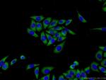 MMP21 Antibody in Immunocytochemistry (ICC/IF)