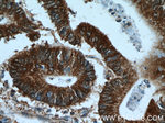 MMP21 Antibody in Immunohistochemistry (Paraffin) (IHC (P))