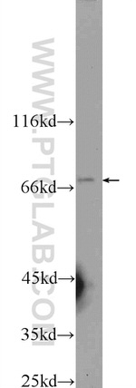 MMP21 Antibody in Western Blot (WB)