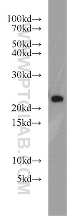 RAB8B Antibody in Western Blot (WB)