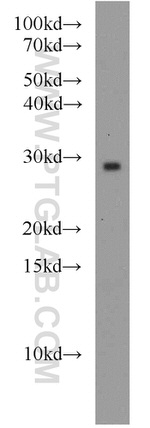 RAB8B Antibody in Western Blot (WB)