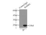 RAB8A Antibody in Immunoprecipitation (IP)