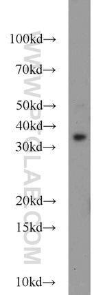 FOXE3 Antibody in Western Blot (WB)