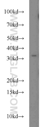 FOXE3 Antibody in Western Blot (WB)