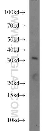 FOXE3 Antibody in Western Blot (WB)