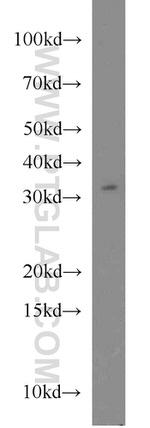 FOXE3 Antibody in Western Blot (WB)