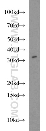 FOXE3 Antibody in Western Blot (WB)