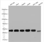 MAT2A Antibody in Western Blot (WB)