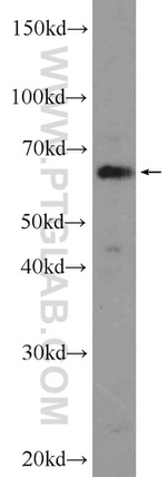 TBL1XR1 Antibody in Western Blot (WB)