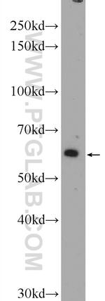 TBL1XR1 Antibody in Western Blot (WB)