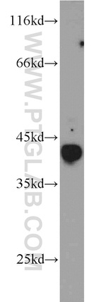 TAL1 Antibody in Western Blot (WB)