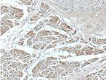 SEPN1 Antibody in Immunohistochemistry (Paraffin) (IHC (P))