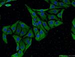 SCN10A Antibody in Immunocytochemistry (ICC/IF)