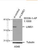 LIMS1 Antibody in Western Blot (WB)