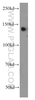 TRIM33 Antibody in Western Blot (WB)