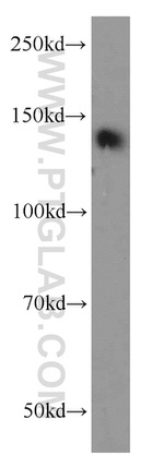 TRIM33 Antibody in Western Blot (WB)