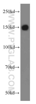 TRIM33 Antibody in Western Blot (WB)