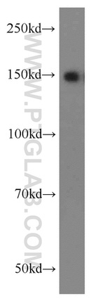 TRIM33 Antibody in Western Blot (WB)