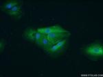 PYGB Antibody in Immunocytochemistry (ICC/IF)