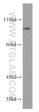 PYGB Antibody in Western Blot (WB)