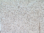 PYGB Antibody in Immunohistochemistry (Paraffin) (IHC (P))