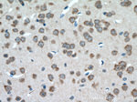 PYGB Antibody in Immunohistochemistry (Paraffin) (IHC (P))