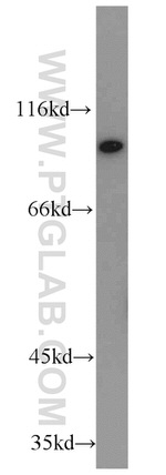 PYGB Antibody in Western Blot (WB)