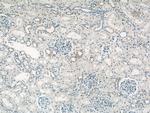 PKA C-beta Antibody in Immunohistochemistry (Paraffin) (IHC (P))