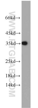 PKA C-beta Antibody in Western Blot (WB)