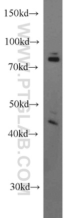 HLA-A Antibody in Western Blot (WB)