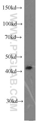 HLA-A Antibody in Western Blot (WB)