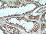 PGAP1 Antibody in Immunohistochemistry (Paraffin) (IHC (P))